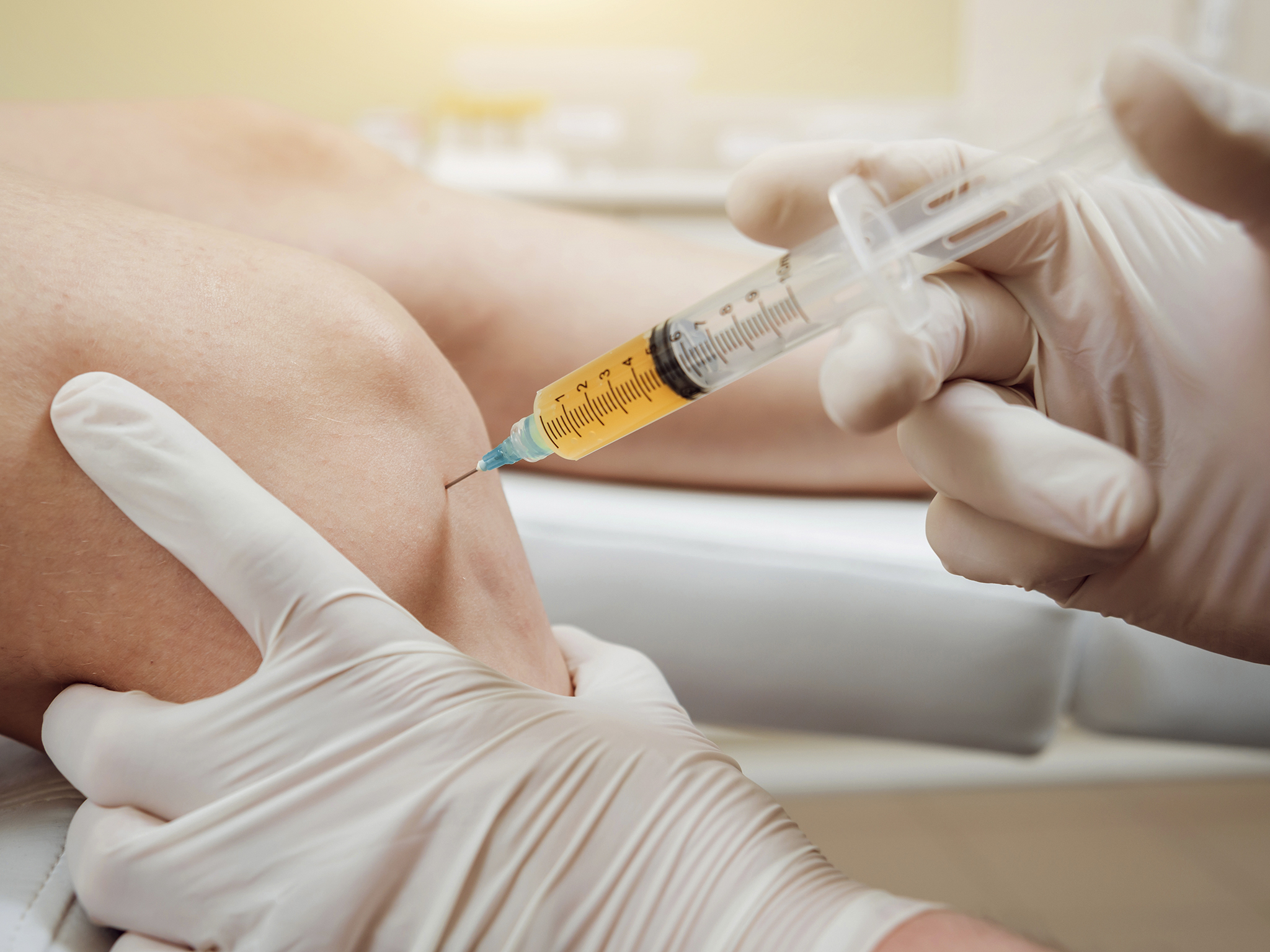 Viscosuplementación articular